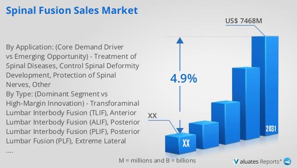 Spinal Fusion Sales Market